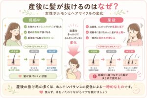 女性ホルモンの急激な変化に伴う抜け毛を図解